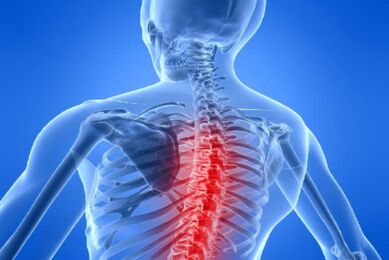 Compresia măduvei spinării în osteocondroza toracică